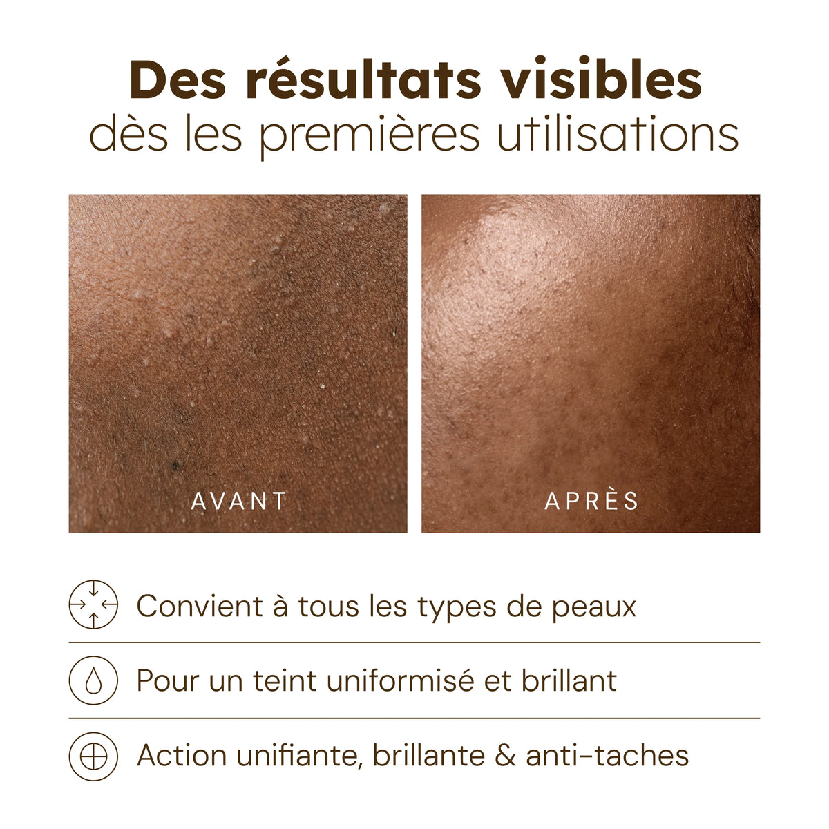Huile visage au Curcuma — photo 2