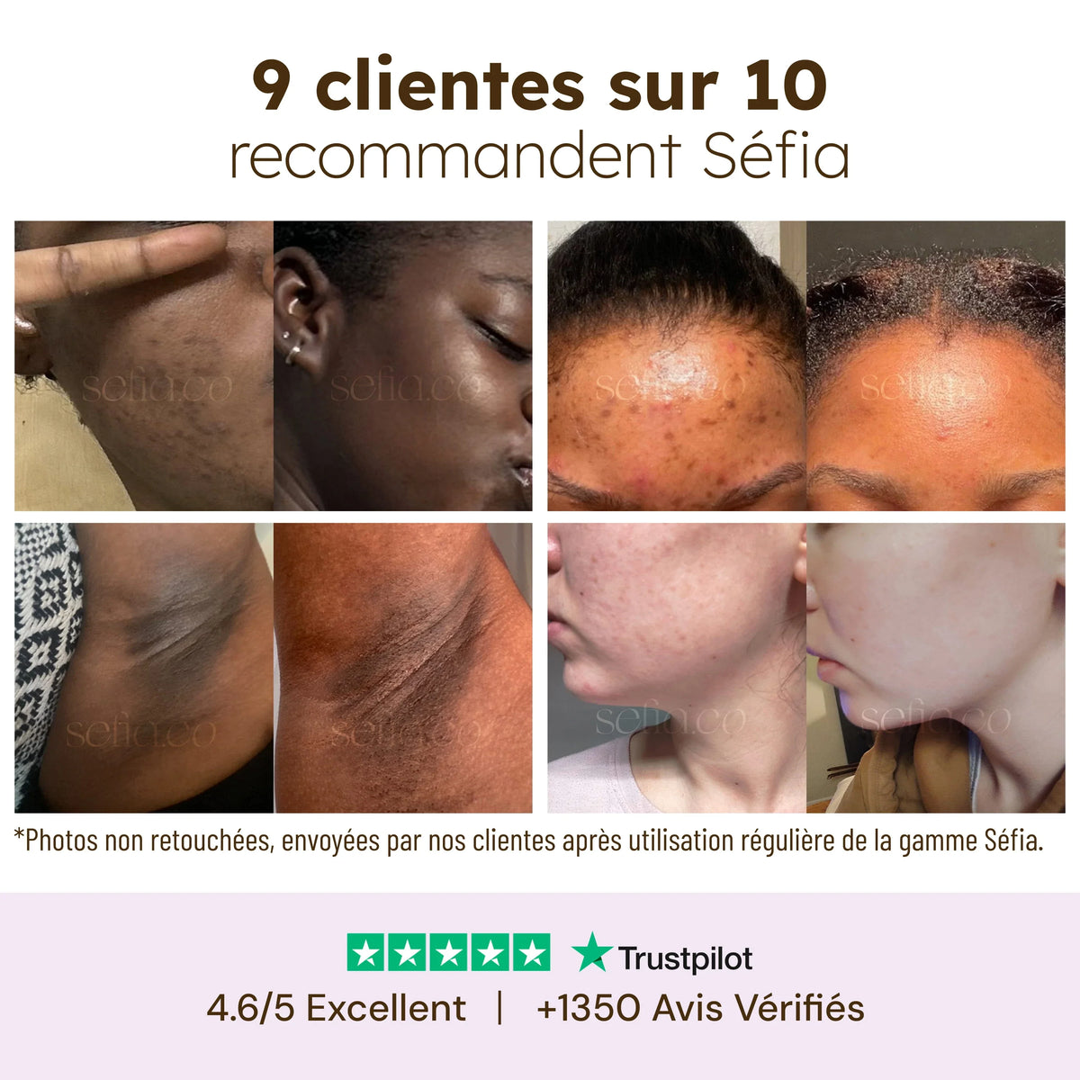 Baume Masque nourrissant lèvres — photo 3