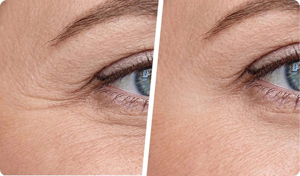 Avant / après : hydratation intense