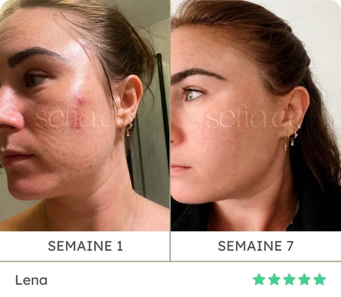 Avant / après de Léna : semaine 1 puis semaine 7