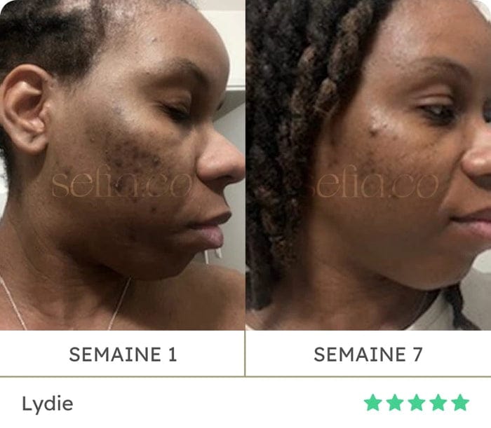 Avant / après de Lydie : semaine 1 puis semaine 7