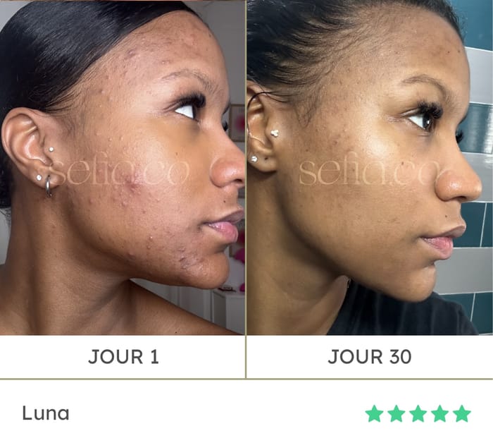 Avant / après de Luna