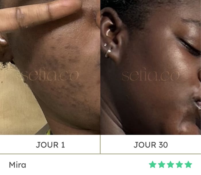 Avant / après de Mira