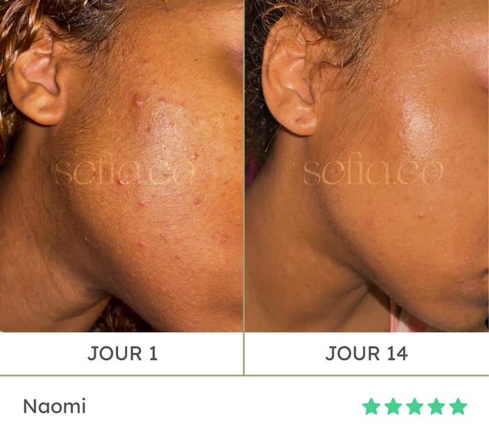 Avant / après de Naomi